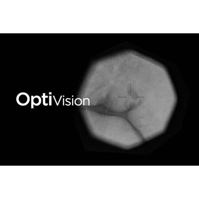 OptiVision